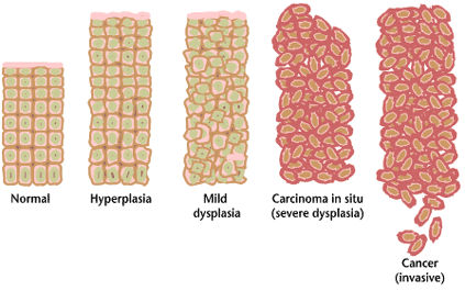 Cancerous cells